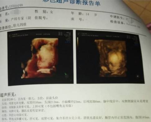 快手张佳伟id快手号_00后李允熙快手id号_00后怀孕李允熙被抛弃